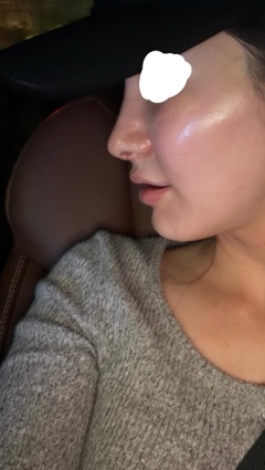 クラブ エスケープ りな 肌艶完璧💯1