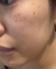 クラブ ロエ るり 10/181